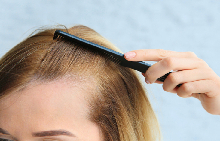 underlying medical conditions that cause hair loss