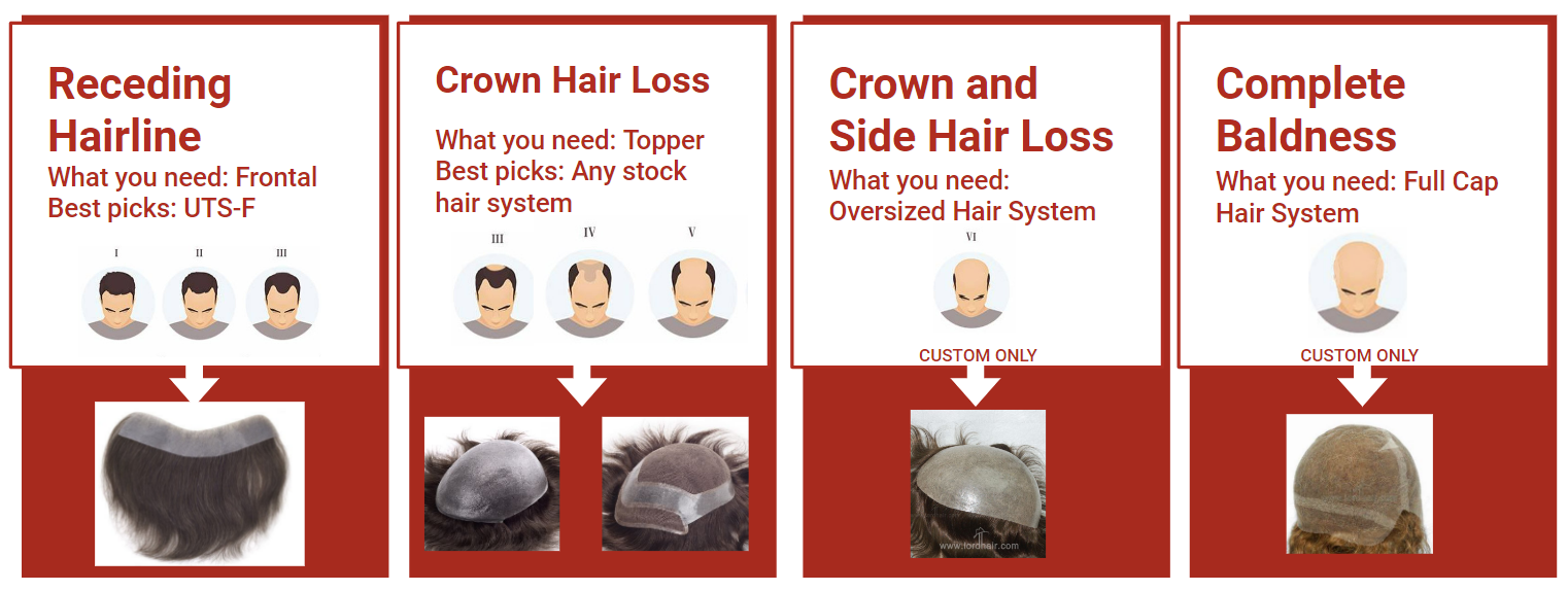 hair system topper frontal