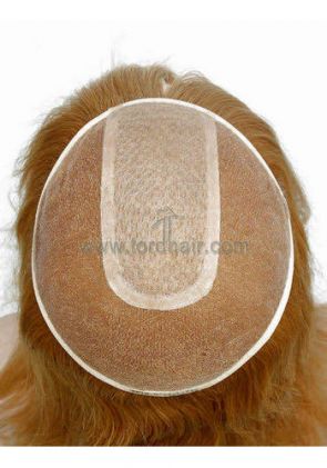 yj183 hair replacement system