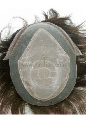 jq1175 hair replacement system