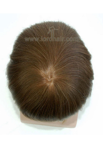 jq1158 hair replacement system