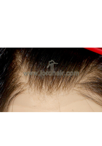 l20 hair replacement system