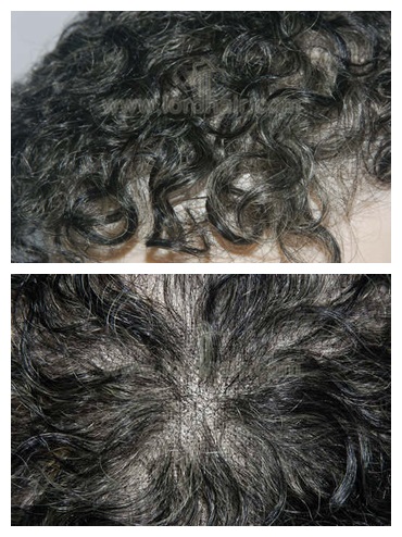 t481 hair toupee