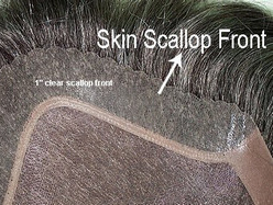 skin hair replacement scallop front