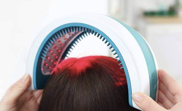 hairloss hair system