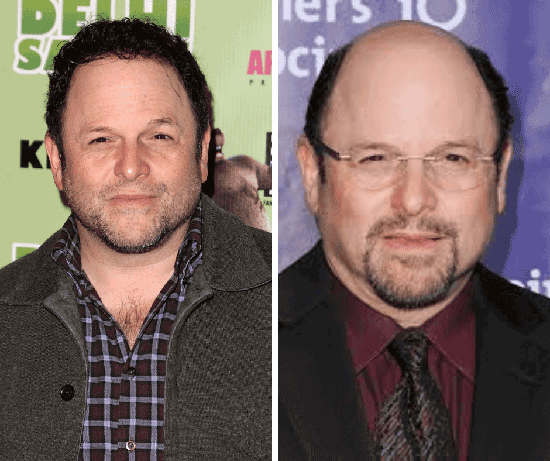actors with hair loss