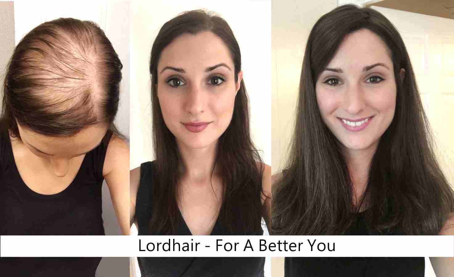 hair system before & after