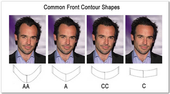 Front contour shapes for hairsystems