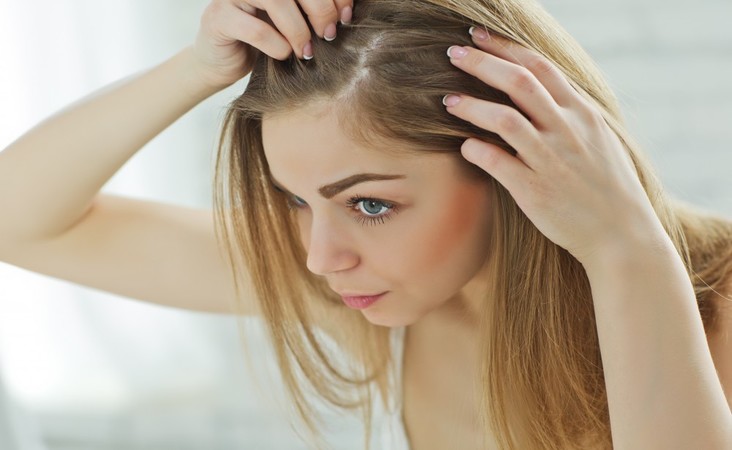 What causes hair loss after pregnancy
