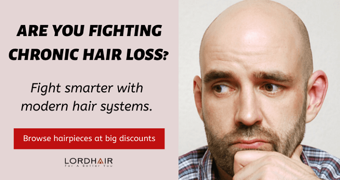 Male Hair Thinning at Crown: Hairfall Causes and Treatments [Updated for  2021]