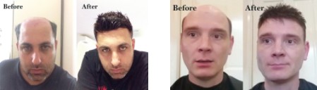 lordhair-mens-hair-systems-before-and-after
