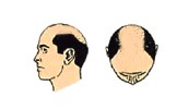 lordhair-regular-size-base-hair-system