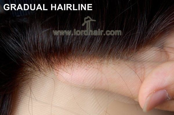 gradual hairline