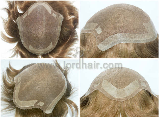 mono hair replacement system with skin perimeter